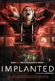 İmplant izle